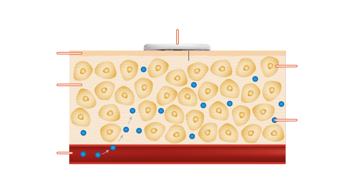 Diagram showing how the interstitial fluid and glucose works with the FreeStyle Libre 3 System